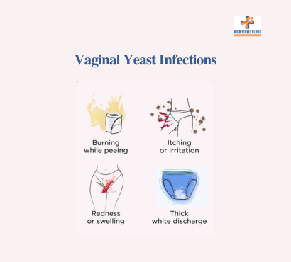Vaginal Yeast Infections: Common Culprits for Indian Women