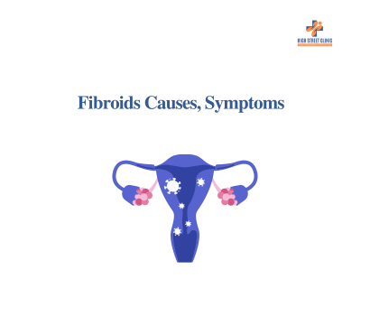 Fibroids Causes, Symptoms & Natural Relief Options