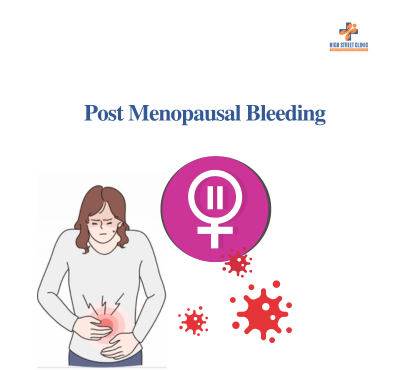 Postmenopausal Bleeding: Red Flags for Immediate Attention